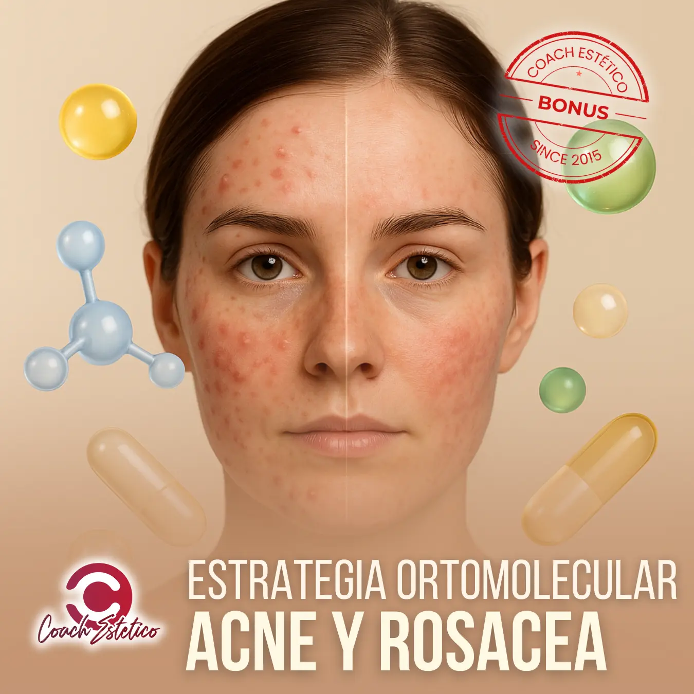 Estrategia Ortomolecular · Acné y Rosácea