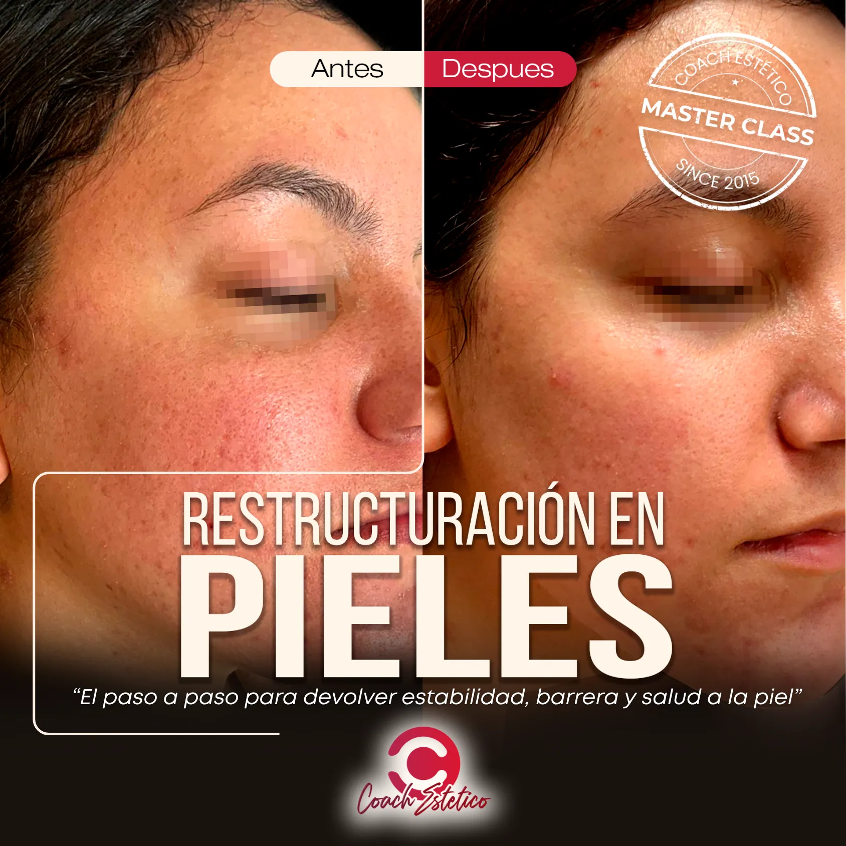 Restructuración en Pieles