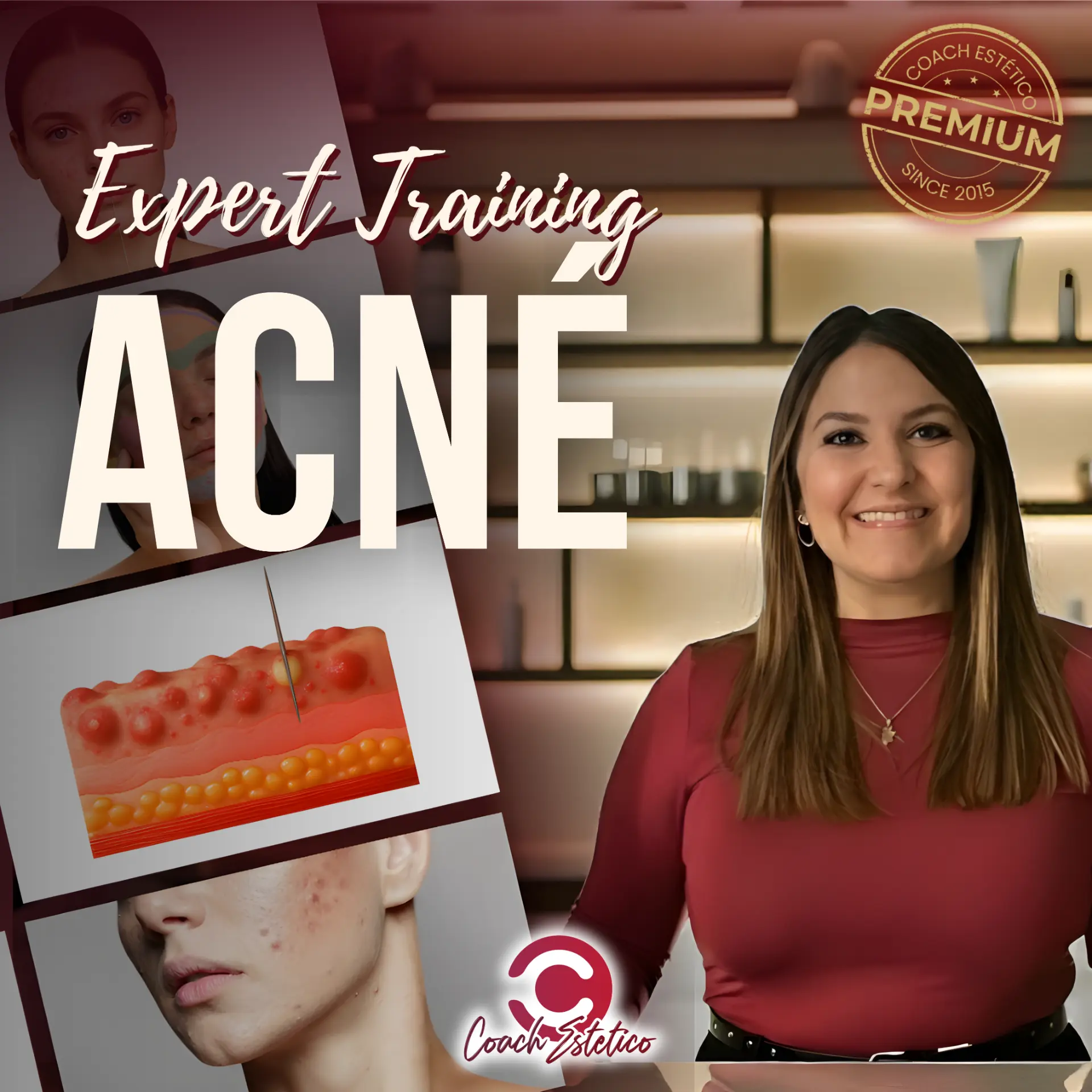 Expert Training Acné