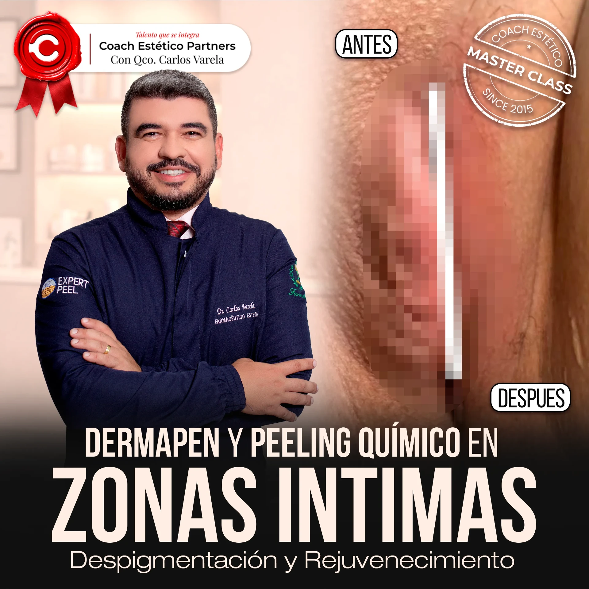 Dermapen y Peeling Químico en Zonas Íntimas