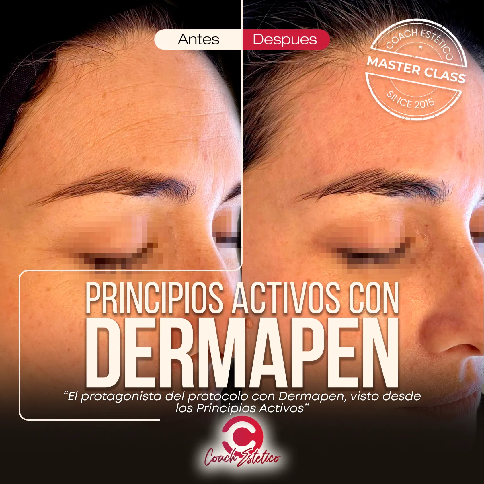 Principios Activos con Dermapen