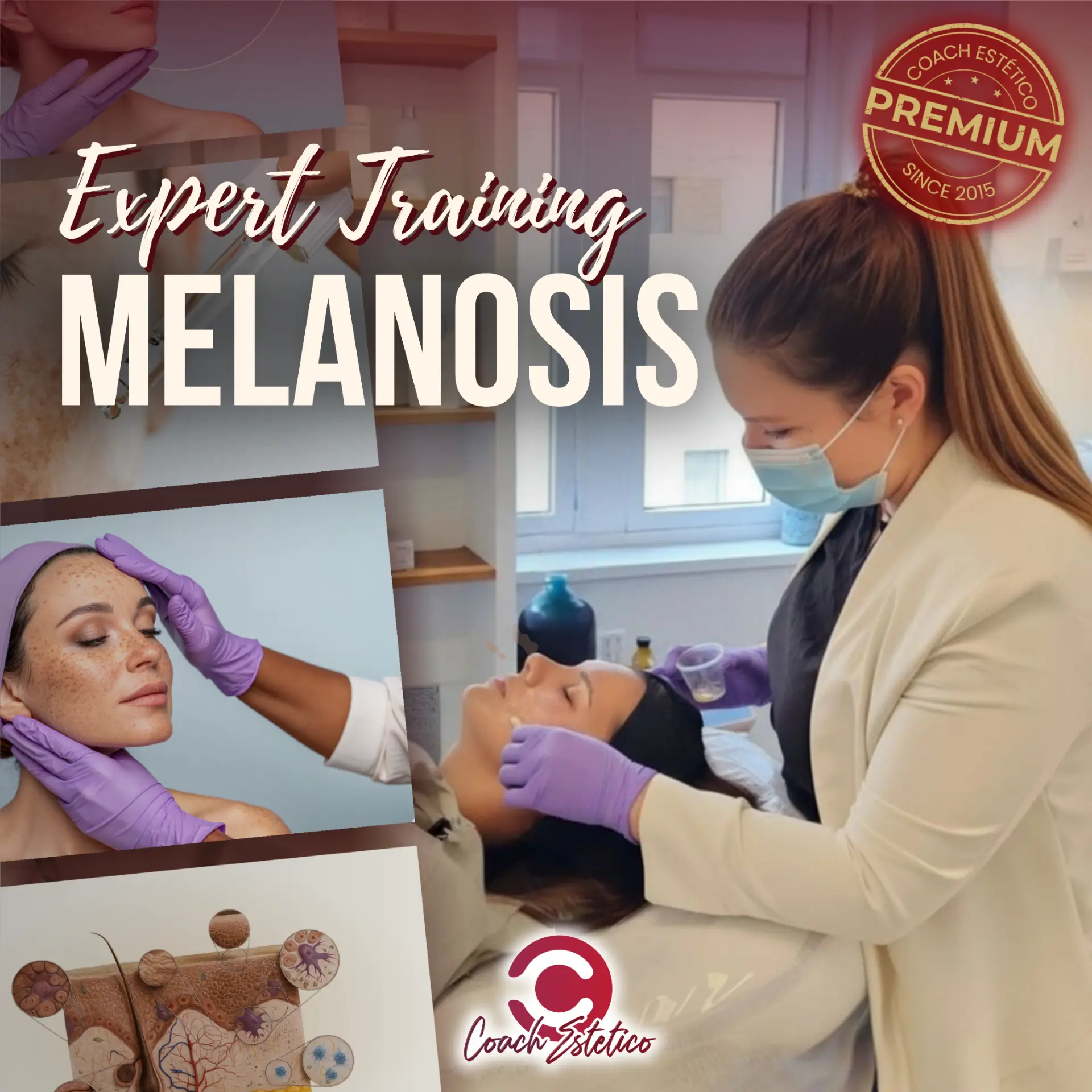 Expert Training Melanosis