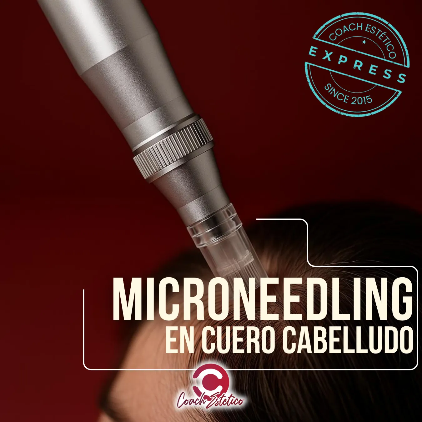 Microneedling en Cuero Cabelludo